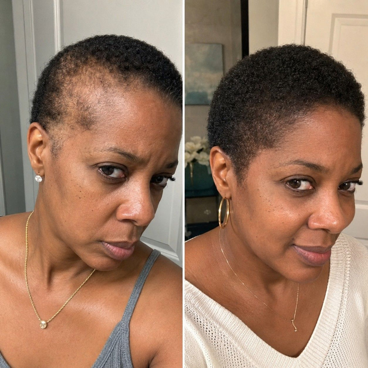 My edges are finally back - Felicia G.