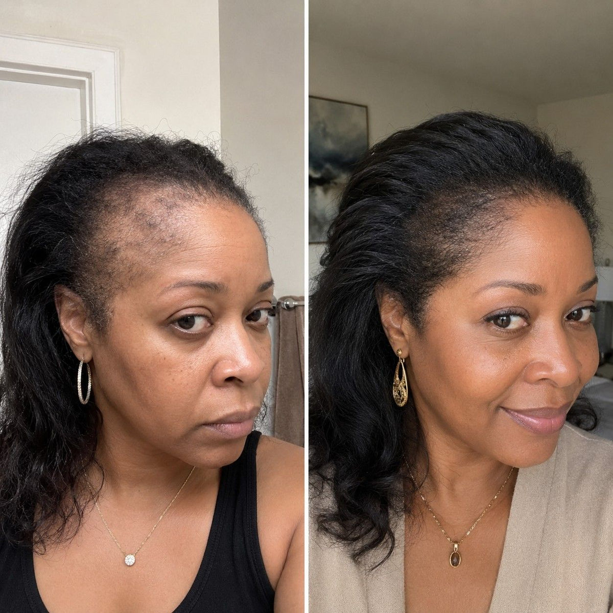 4 months and my edges are full - Keisha L.