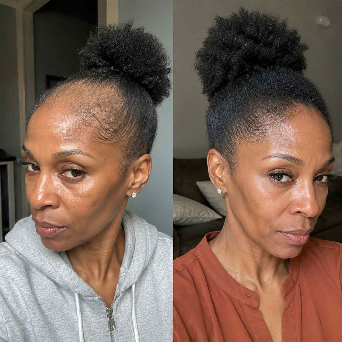 My edges are finally back - Felicia G.