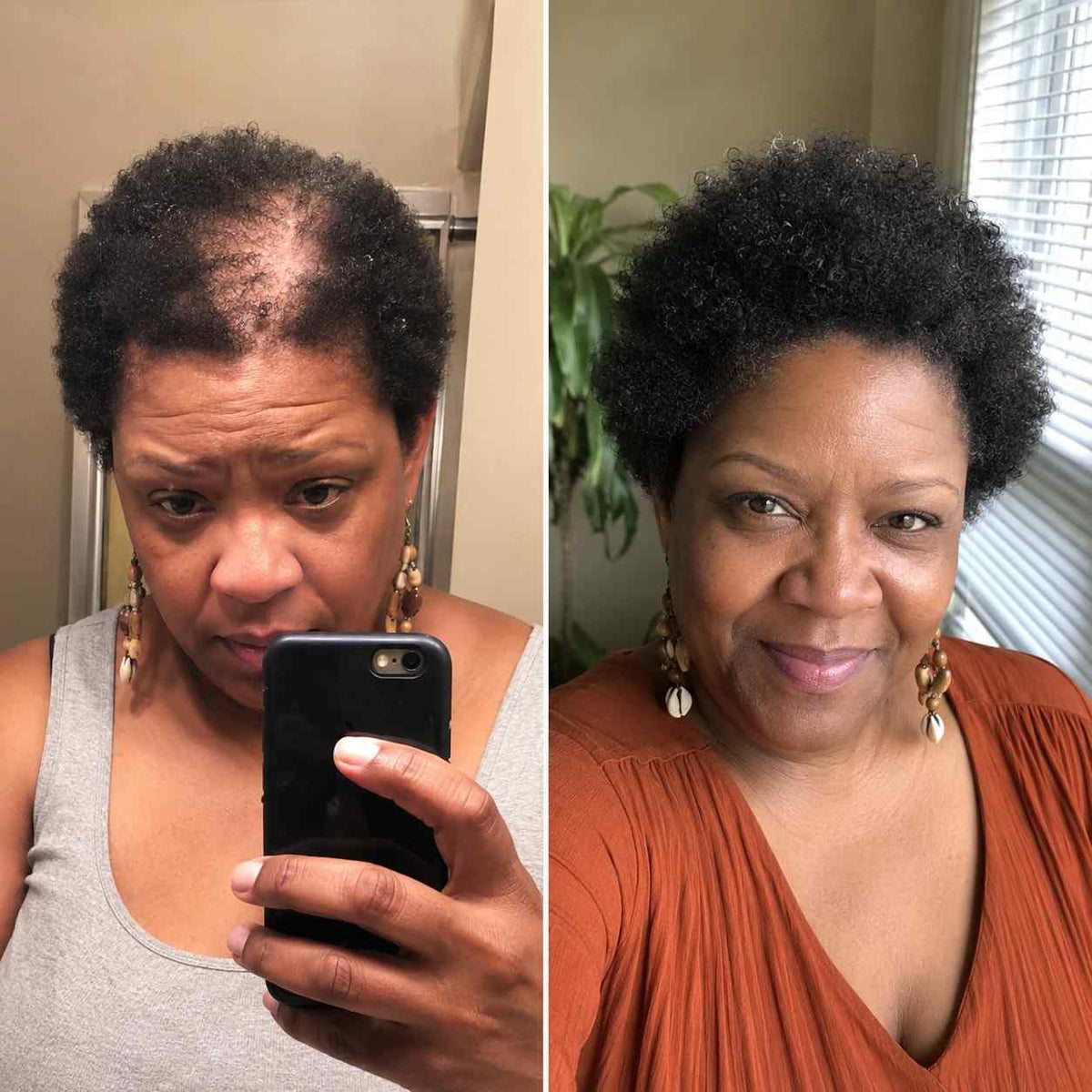 Back to myself after 8 weeks - Tameka H.